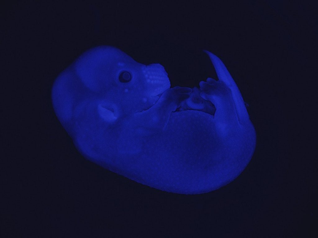 This in vivo mouse embryo was used to gain insight into embryo-development mechanisms in mammals and the reasons for certain malformations. Laboratory of Developmental Genomics, Denis Duboule (04/11/2019) | © Catherine Leutenegger/EPFL