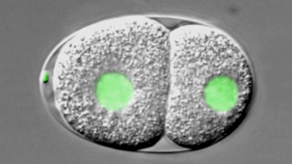 C. elegans embryo carrying a GFP-histone2B fusion protein imaged using dual time-lapse differential interference contrast (DIC) and overlaid fluorescence microscopy. The embryo is ~50 μm long.