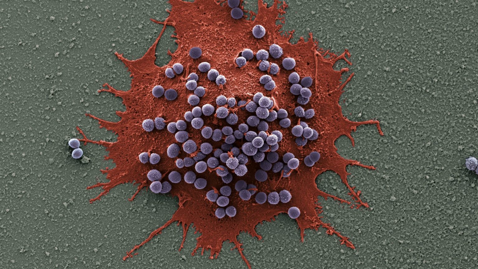 Drosophila macrophages engulfing Staphylococcus aureus bacteria | © Claudia Melcarne/ EPFL