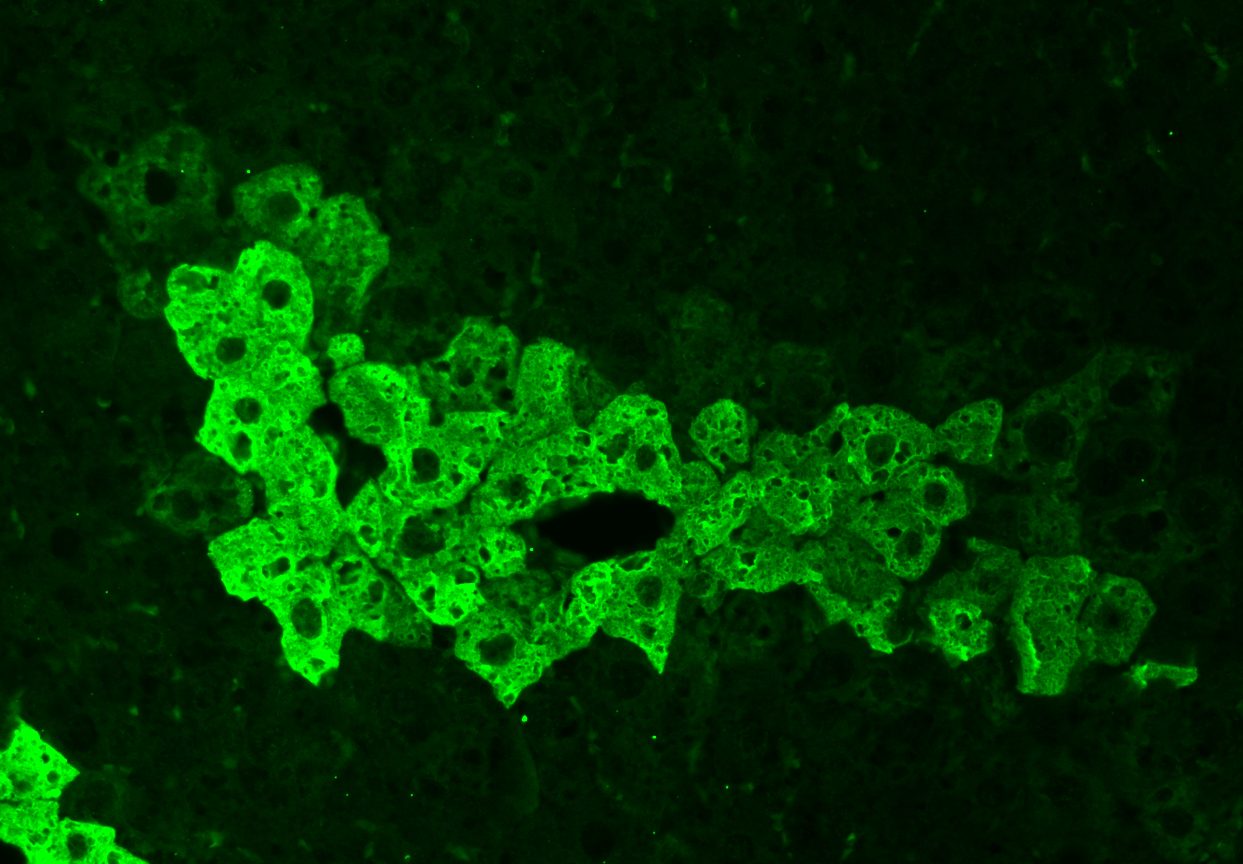 Pericentral Veins | © EPFL