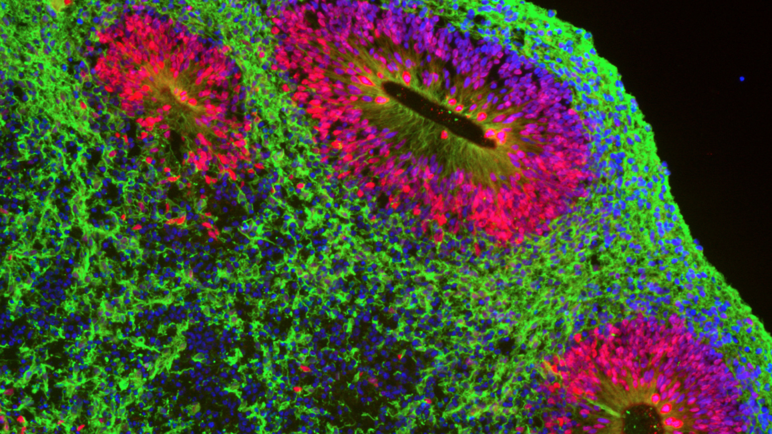 Shown here is the internal, self-organised structure of a stem cell derived, human cerebral organoid. Rosettes of neural progenitor SOX2 positive radial glia (red) are interspersed with TUJ1 positive newborn neurons (green). Nuclei are marked in blue | © Christopher Playfoot & Didier Trono