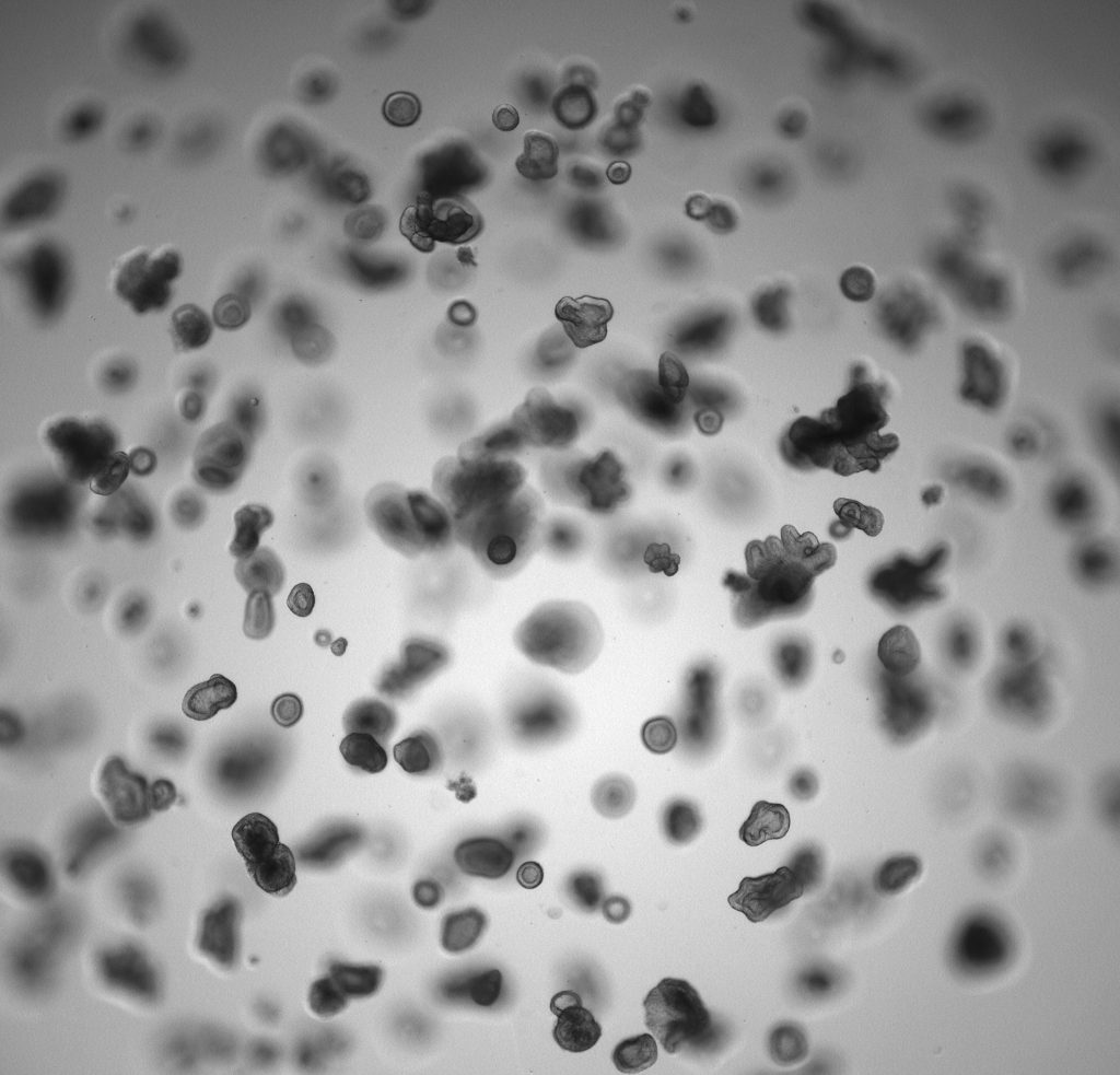 Brightfield image of luminal cell derived organoids