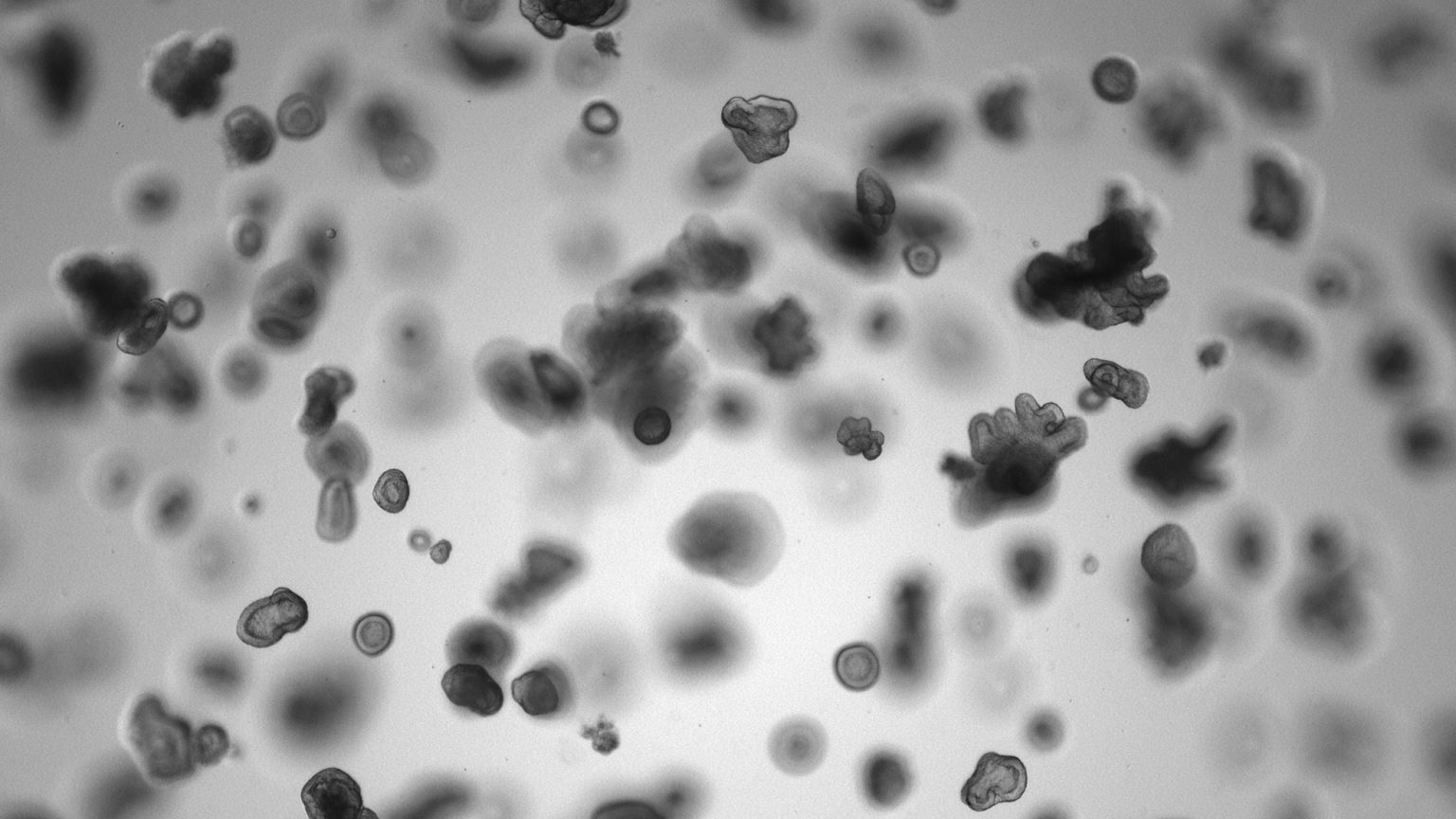 Brightfield image of luminal cell derived organoids