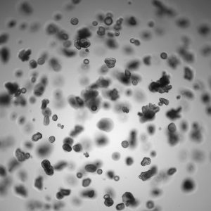 Brightfield image of luminal cell derived organoids