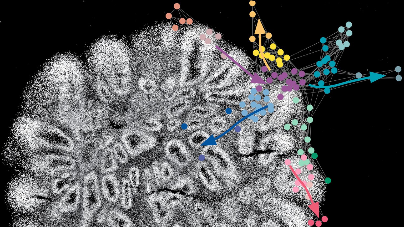 Human brain organoid