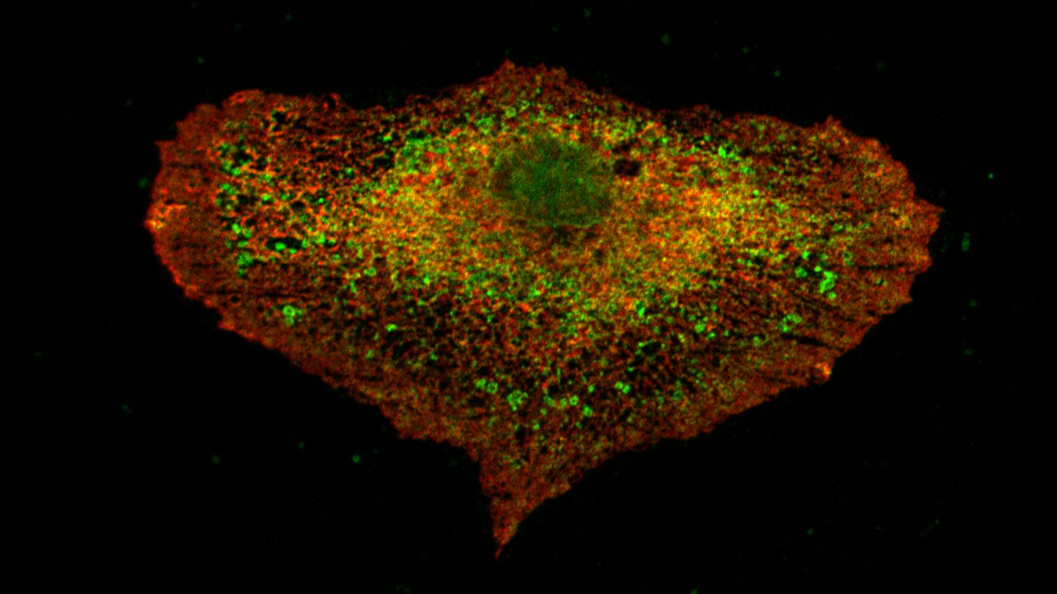 RPE1 Cells Stained With Antibodies Recognising Two Membrane Proteins, ZFYVE27 In Red And VAP A In Green | © EPFL