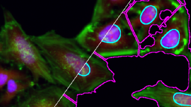 Cell Segmentation in ImageJ-Fiji