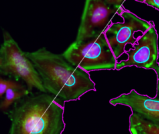 Cell Segmentation in ImageJ-Fiji