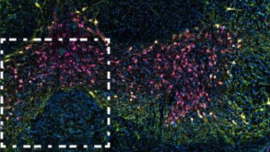 DEVILS workflow applied to 3 channel lighthseet cleared brain