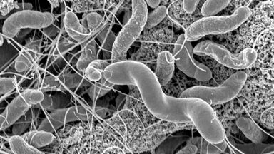 The human pathogen Vibrio cholerae
