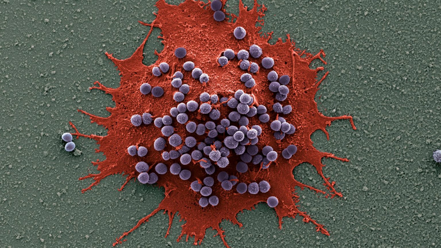 Phagocytosis of bacteria by a Drosophila macrophage