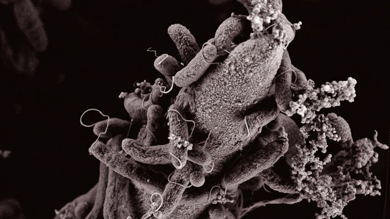 Cholerae bacteria by electron microscopy
