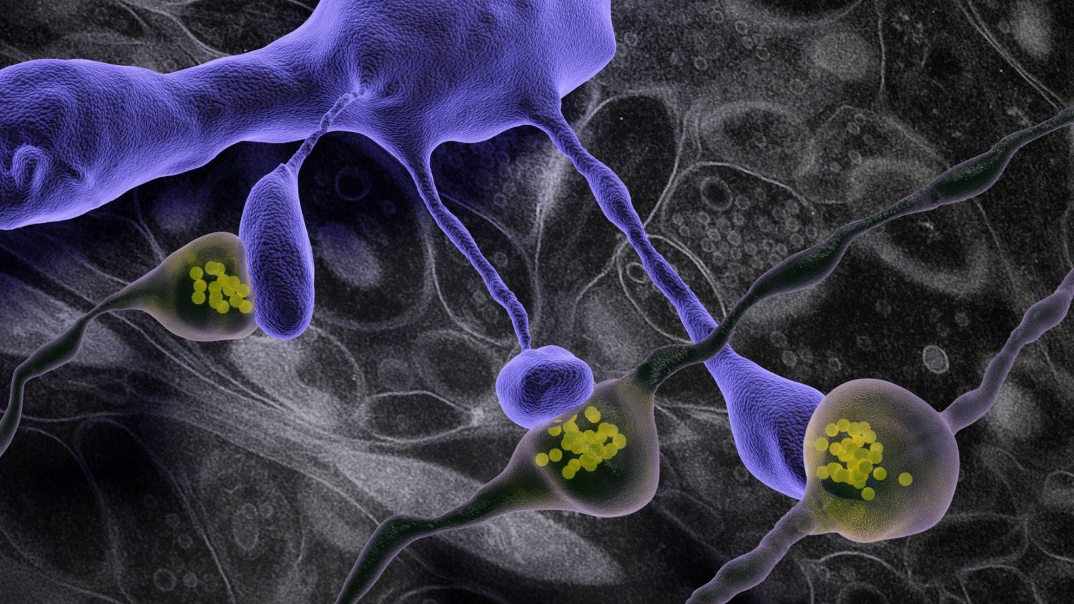 3D model of dendritic spines (purple) making synapses with axons containing vesicles (yellow). Background shows electron microscope image of brain tissue. ©EPFL-Graham Knott
